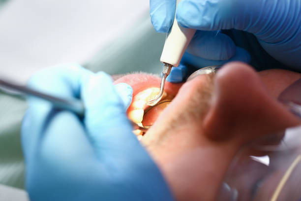 Best Emergency Gum Treatment in Lampasas, TX